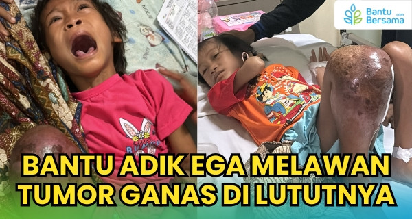 Bantu Adik Ega Pulih Dari Tumor Ganas