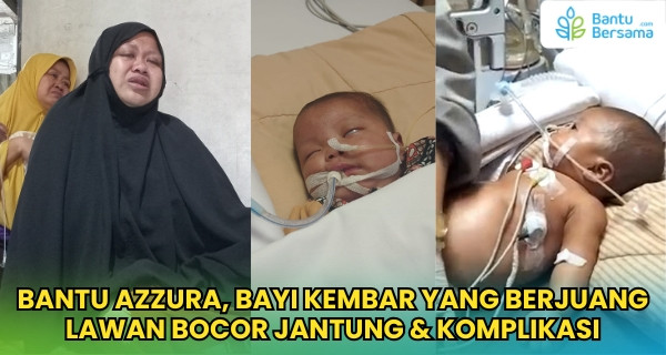 Bantu Azzura, Bayi Kembar Yang Berjuang Lawan Bocor Jantung & Komplikasi