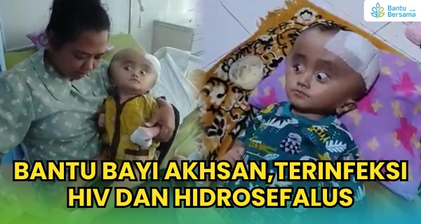Bantu Bayi Akhsan,Terinfeksi HIV Dan Hidrosefalus
