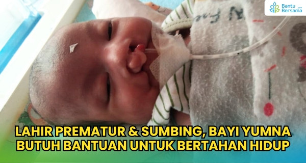 Bayi Yumna, 34 Hari Berjuang Bertahan Hidup Di Ruang NICU