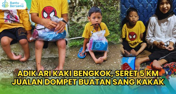 KAKI BENGKOK SEJAK LAHIR! Dik Ari Seret Tubuh Jualan Demi Bisa Makan