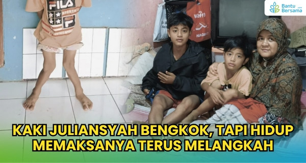 Kaki Juliansyah Bengkok, Tapi Harus Jualan Demi Menghidupi Keluarga