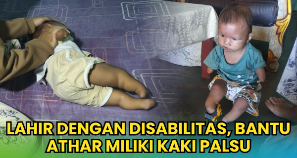 Lahir Dengan Disabilitas, Bantu Athar Miliki Kaki Palsu