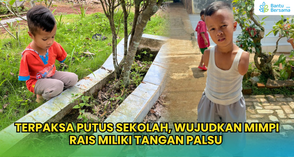 Terpaksa Putus Sekolah, Wujudkan Mimpi Rais Miliki Tangan Palsu
