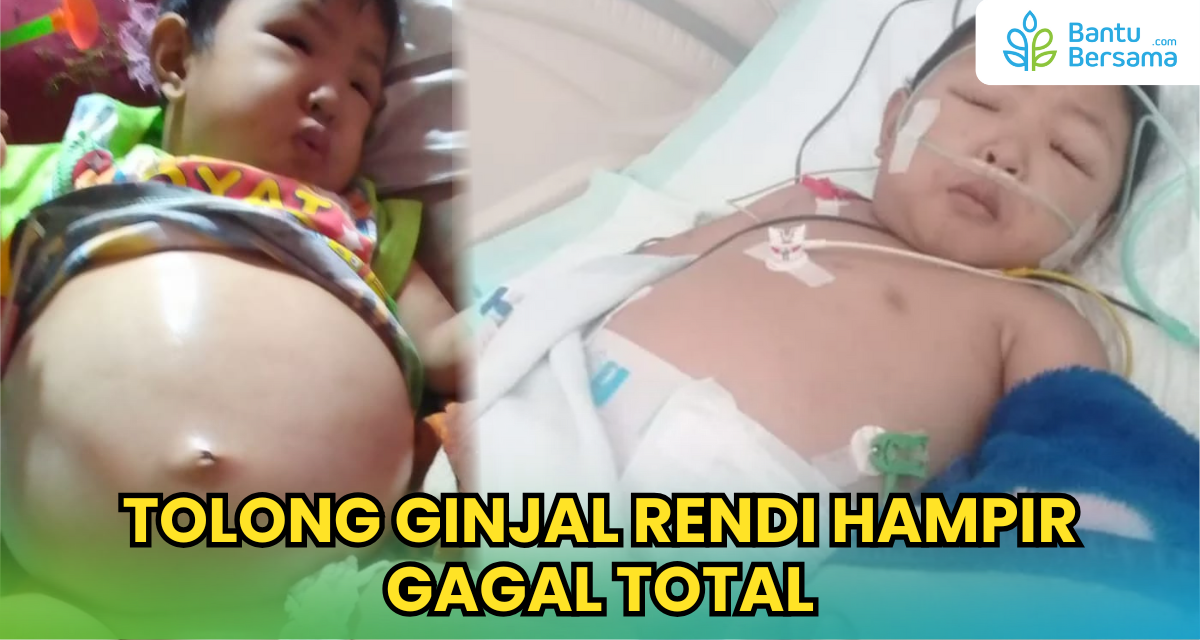 Tolong Ginjal Rendi Hampir Gagal Total