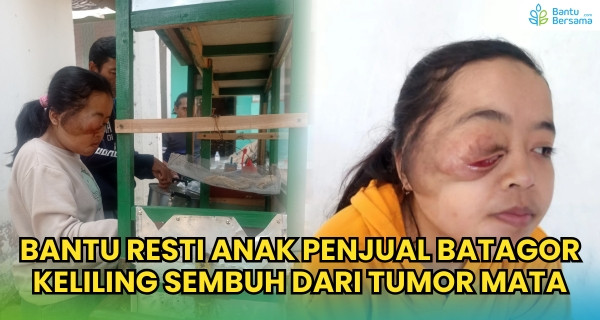 Tumor Di Mata & Wajah, Resti Butuh Bantuan Operasi