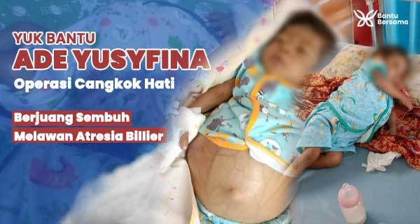 Urgent! Bantu Ade Yusyfina Cangkok Hati