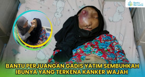 Bantu Gadis Yatim Obati Kanker Wajah Ibunya