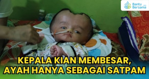 Kepala Kian Membesar Ayah Hanya Sebagai Satpam