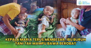 Kepala Maria Terus Membesar, Ibu Buruh Tani Tak Mampu Bawa Berobat
