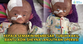 Kepala Semakin Membesar, Tubuhnya Kaku, Bantu Sheyna Lanjutkan Operasi