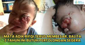 Mata Rifqi Membesar Dan Berdarah