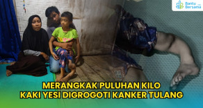 Merangkak Puluhan Kilo, Kaki Yesi Digrogoti Kanker Tulang
