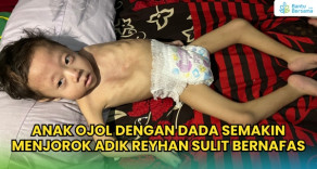 Napas Reyhan Kian Sesak, Anak Driver Ojol Butuh Pertolongan