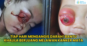 TIAP HARI MENGANGIS DARAH! Bantu Khalila Berjuang Melawan Kanker Mata
