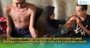 Tubuh Melepuh & Kulit Rapuh, Bantu Kang Ujang Berobat!