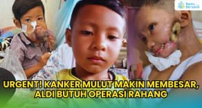 URGENT! Kanker Mulut Makin Membesar, Aldi Butuh Operasi Rahang